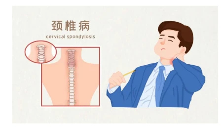 ¿Sobre el insomnio? ¿Has considerado la causa de la columna cervical?